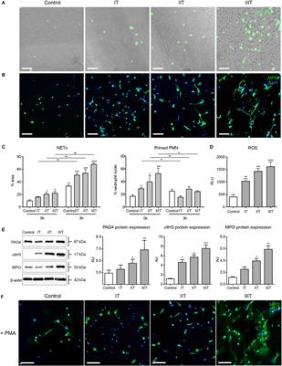 Multimodal Regulation of NET Formation in Pregnancy: Progesterone Antagonizes the Pro-NETotic Effect of Estrogen and G-CSF